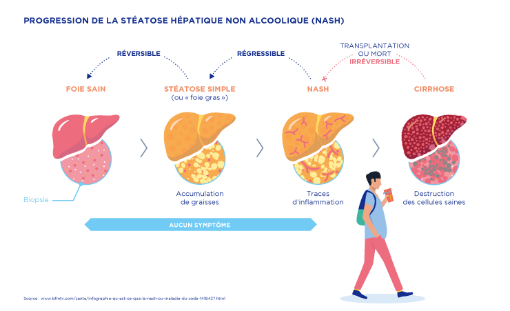 Les Maladies Du Foie Vont-elles Se Multiplier ? | Leem